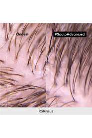 LOréal Professionnel Serie Expert Scalp Advanced Yağlanma Karşıtı ve Saç Derisi Dengeleyici Şampuan 500 ml - Sebum Kontrol & Hacim Artışı - 8